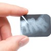 Dental X-ray