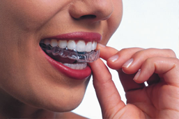 Invisalign®