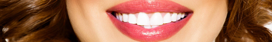 Header - Vivera® Retainers