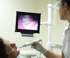 Intraoral Camera